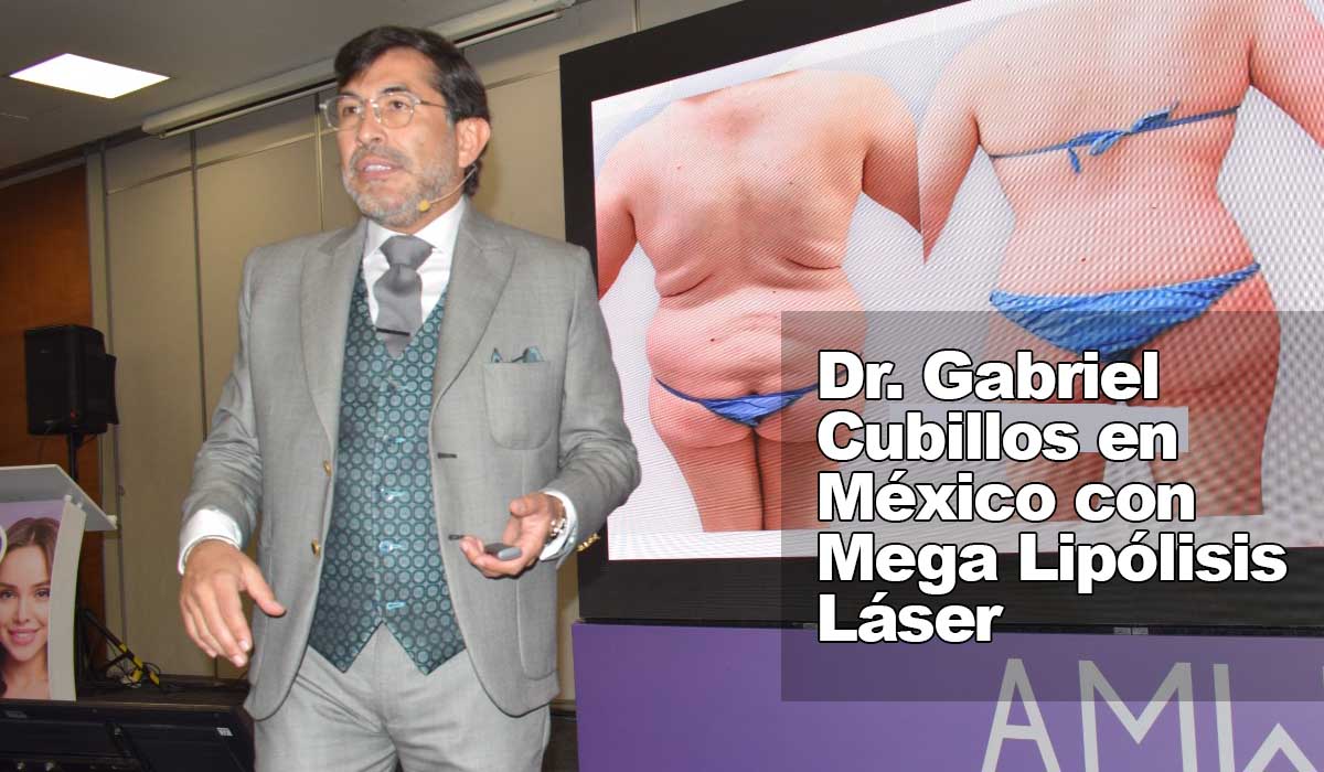 Ahora los mexicanos pueden adelgazar con tratamiento Lipólisis Láser