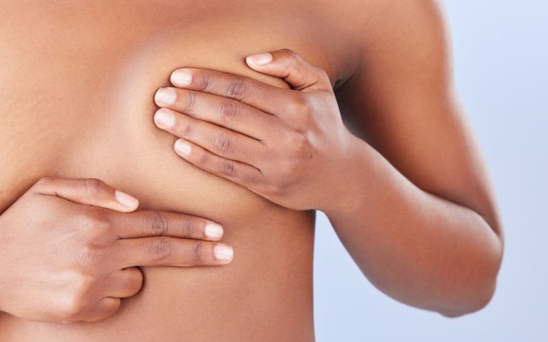 Cómo mejorar la firmeza de los senos tras el embarazo sin cicatrices